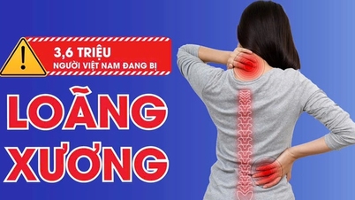 ជំងឺពុកឆ្អឹង និងការបាក់ឆ្អឹងបន្ទាប់ពីអាយុ 40 ឆ្នាំ៖ ហានិភ័យស្ងាត់ៗ ប៉ុន្តែអាចការពារបាន។
