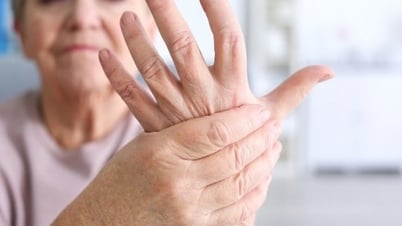 Augmentation du nombre de jeunes victimes d'accidents vasculaires cérébraux pendant le Têt