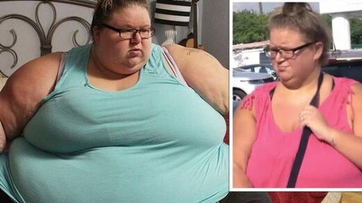 The unbelievable current life after losing weight of a woman weighing 357 kg, so fat that she faces the risk of being bedridden for life