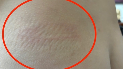 ครูถูกกล่าวหาทำร้ายร่างกายแล้วเรียกตัวเองว่า “ท่าน”