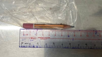 Un niño de 5 años se metió un lápiz en el ano y necesitó atención de emergencia
