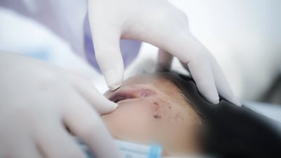 Ô tô chở đoàn hành hương 24 người tông vào xe tải, nhiều nạn nhân cấp cứu