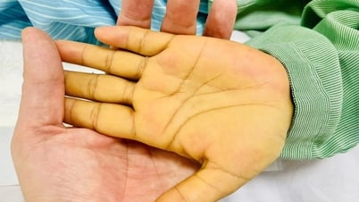 Une femme à la peau jaune a failli mourir d'une maladie courante