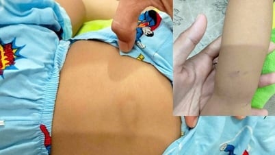 Informe sobre los resultados de la investigación del presunto caso de abuso, suspendiendo las actividades del grupo de niños en el barrio de Mui Ne