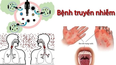 The Ministry of Health requires strengthening disease prevention and control during the changing seasons.