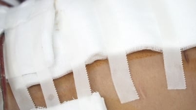Liposuction accident in Ho Chi Minh City: Victim "earnestly" had surgery despite having underlying disease?