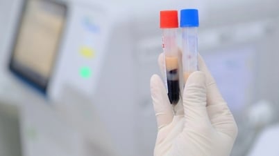 危険な病気により患者の血液が牛乳のように濁る