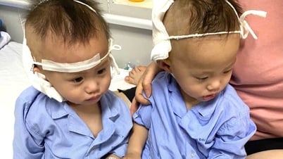2 bé sinh đôi bị câm điếc ở Thanh Miện đã được hỗ trợ hơn 52 triệu đồng
