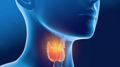 Do not be subjective when having Graves' disease during pregnancy