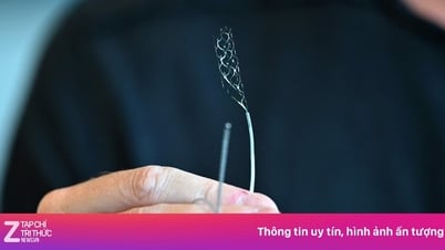 السباق لوضع الرقائق في الدماغ البشري