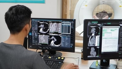 새로운 기술로 증상이 나타나기 전에 암을 감지합니다.