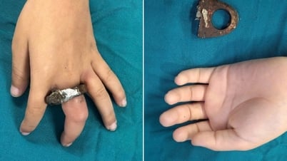 Hanoi: Una familia corta una puerta para rescatar a un niño atrapado en una esclusa