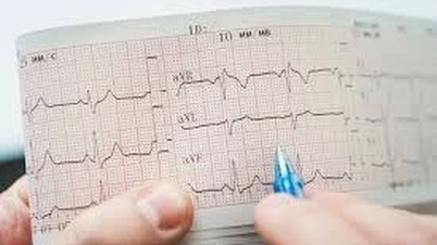 Bé 5 tuổi có nhịp tim 110-120 nhịp/phút có sao không?