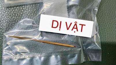 Un cure-dent de 7 cm de long a été retrouvé dans l'estomac d'un petit garçon depuis plus de 4 mois.