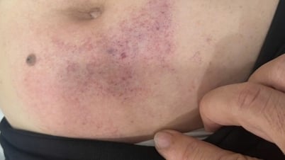 التحقق من حالة قيام معلمة روضة أطفال بالضرب على نائبة مديرة روضة أطفال حتى دخولها المستشفى