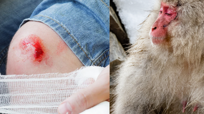 Why do human wounds take longer to heal than animal wounds?