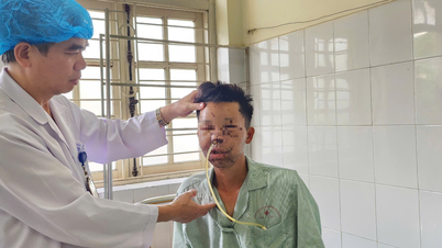 Bị gấu rừng tấn công, người đàn ông biến dạng cả mặt