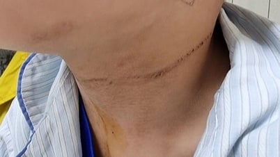 5-jähriges Kind spielt mit Wäscheschnur, hat Schnur um den Hals gebunden