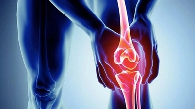 L'arthrose : l'ennemi qui cause le handicap