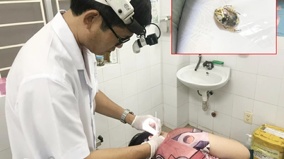 Gắp côn trùng ra khỏi tai nữ bệnh nhân tại Xuân Lộc