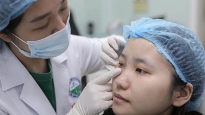 Gen Z ចំណាយជិត 10 លានដើម្បីចាក់ Filler ដើម្បីបំពេញរន្ធភ្នែក