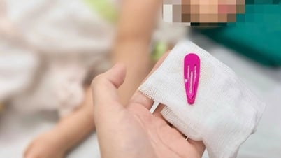 Hà Nội: Bé gái 21 tháng tuổi nuốt kẹp tóc vào bụng