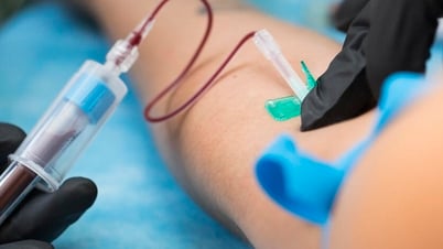 Xét nghiệm máu phát hiện ADN ung thư từ 3 năm trước khi chẩn đoán