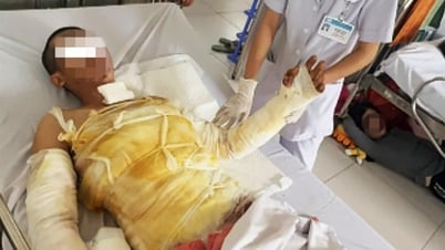 32-jähriger Mann erleidet bei der Reparatur von Schilderbeleuchtung einen Stromschlag und erleidet schwere Verbrennungen