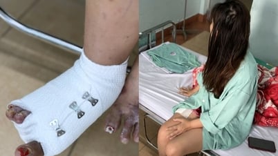 فتاة في مدينة هوشي منه أصيبت بنخر أثناء نقعها في ماء ساخن، وذهبت إلى 4 مستشفيات لكنها فقدت إصبع قدمها