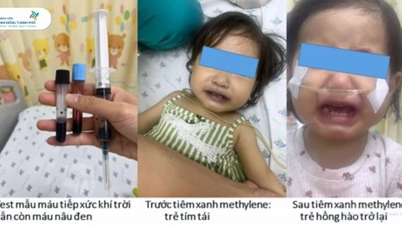 Bác sĩ cảnh báo vì sao nên cẩn trọng khi sử dụng nước giếng để nấu ăn