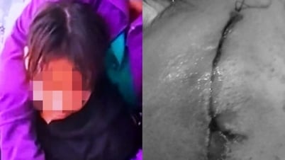Sở Y tế TPHCM nhận nhiều phản ánh “bất thường” tại mái ấm Thiên Thần