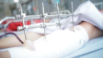 비로 인해 벽이 무너져 위독한 여성 생명을 기적적으로 구해