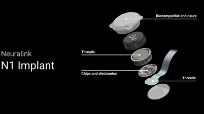Neuralink: គ្រប់គ្រងកុំព្យូទ័រជាមួយខួរក្បាល ហើយសង្ឃឹមសម្រាប់មនុស្សពិការភ្នែក