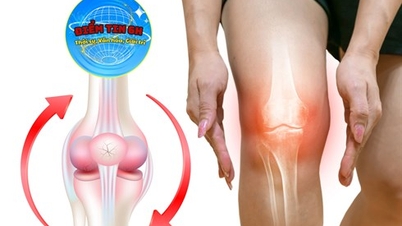 Điểm tin 27-6: Nhiều người trẻ bị loãng xương sớm