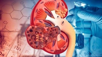 Những dấu hiệu nhận biết ung thư thận