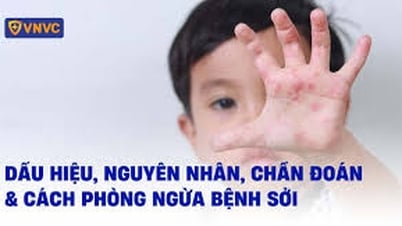 Continue to implement measures to prevent and control measles