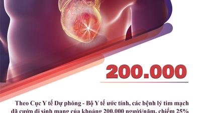 매년 20만 명의 베트남인이 심혈관 질환으로 사망합니다.