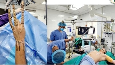 19-8 Hospital performed arthroscopic surgery to repair torn triangular fibrocartilage disc of the wrist with special self-made instruments
