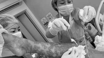 Cứu sống một phụ nữ nhiễm độc toàn thân do dị ứng thuốc