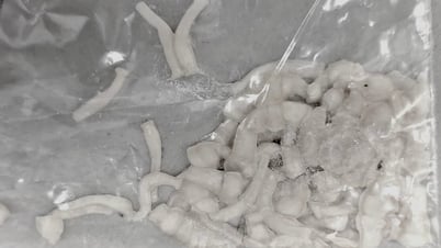 多くの人がよく行う習慣により、3メートルを超える条虫が発見された。