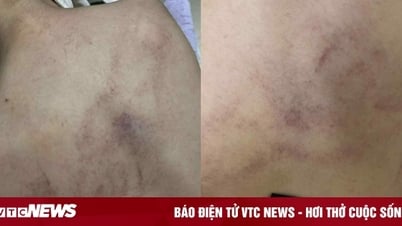 'Giáo viên hay kẻ ác nhân mà đánh trẻ không biết ghê tay'