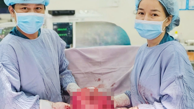 Bệnh viện Đa khoa Thống Nhất phẫu thuật thành công khối u xơ tử cung 'khổng lồ' nặng 7kg