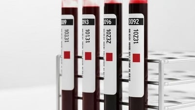 Đột phá: Sắp có máu nhân tạo, truyền được cho tất cả mọi người!