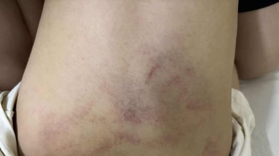 하노이 유치원서 소녀 구타당하고 끌려가… 목격했지만 무시한 교사, 정직 처분
