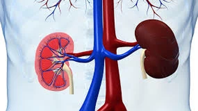 Bị viêm cầu thận có tiến triển thành bệnh thận mạn không?