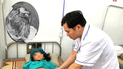 Bụng chướng căng, thiếu nữ 14 tuổi đi khám thì phát hiện khối u 9kg