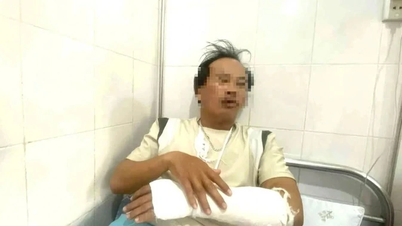 Giám định thương tích Trạm trưởng Trạm bảo vệ rừng để xử lý đối tượng liên quan
