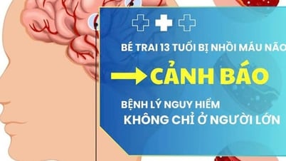 Bé trai 13 tuổi nhồi máu não, cảnh báo nguy cơ đột quỵ ở thiếu niên