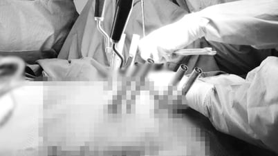 Thang máy đứt cáp rơi thẳng xuống đất, một phụ nữ gãy cột sống nặng nề