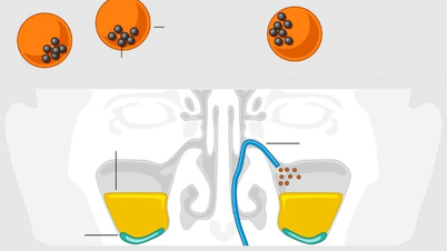 Anwendung von Mikrorobotern bei der Behandlung von Sinusitis mit Hochtechnologie